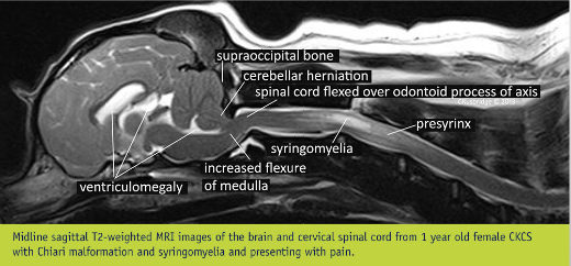 mri-ckcs-with_notes