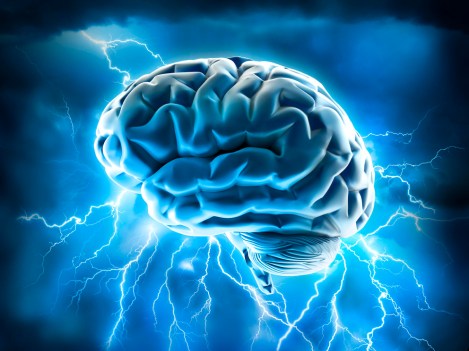 seizure migrains Stock_adventtr.jpg